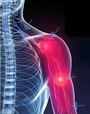 Лимфодренажный аппарат + пульт управления Gapo Alance Choco Brown